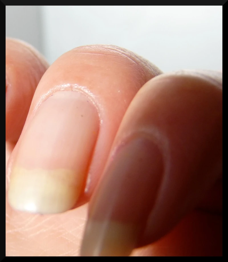 Pas de déshydratation autour des ongles, youpi !